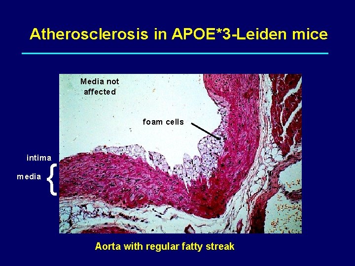 Atherosclerosis in APOE*3 -Leiden mice Media not affected foam cells intima media { Aorta