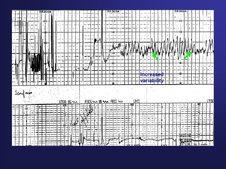 Increased variability 