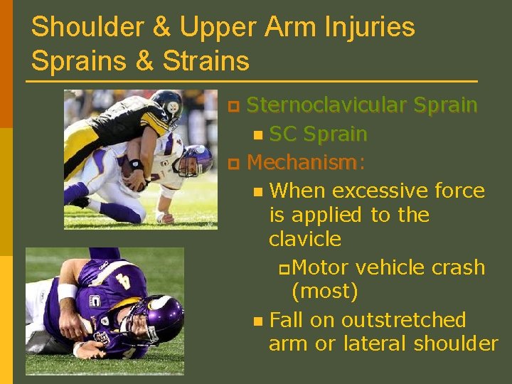 Shoulder & Upper Arm Injuries Sprains & Strains Sternoclavicular Sprain n SC Sprain p
