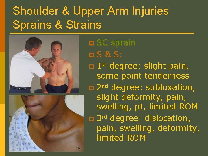 Shoulder & Upper Arm Injuries Sprains & Strains SC sprain p S & S: