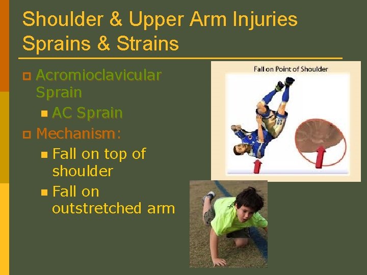 Shoulder & Upper Arm Injuries Sprains & Strains Acromioclavicular Sprain n AC Sprain p