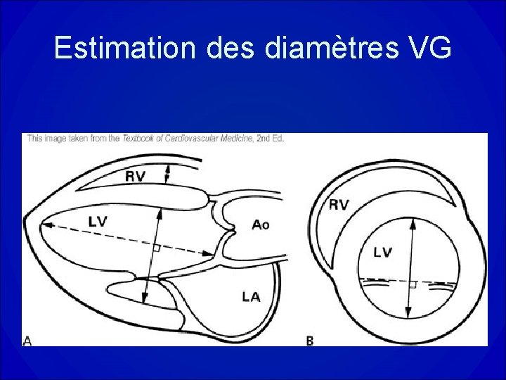 Estimation des diamètres VG 