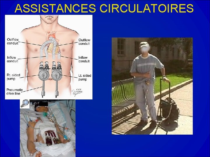 ASSISTANCES CIRCULATOIRES 