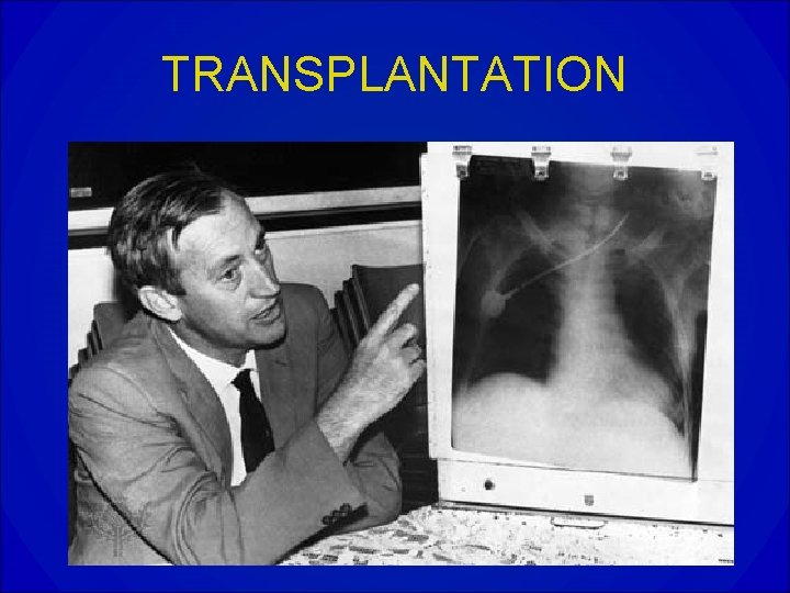 TRANSPLANTATION 