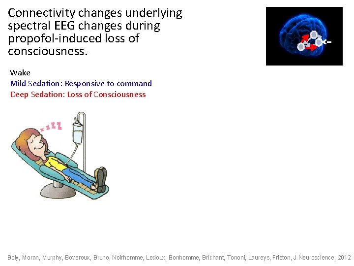 Connectivity changes underlying spectral EEG changes during propofol-induced loss of consciousness. Wake Mild Sedation: Connectivity changes underlying spectral EEG changes during propofol-induced loss of consciousness. Wake Mild Sedation:
