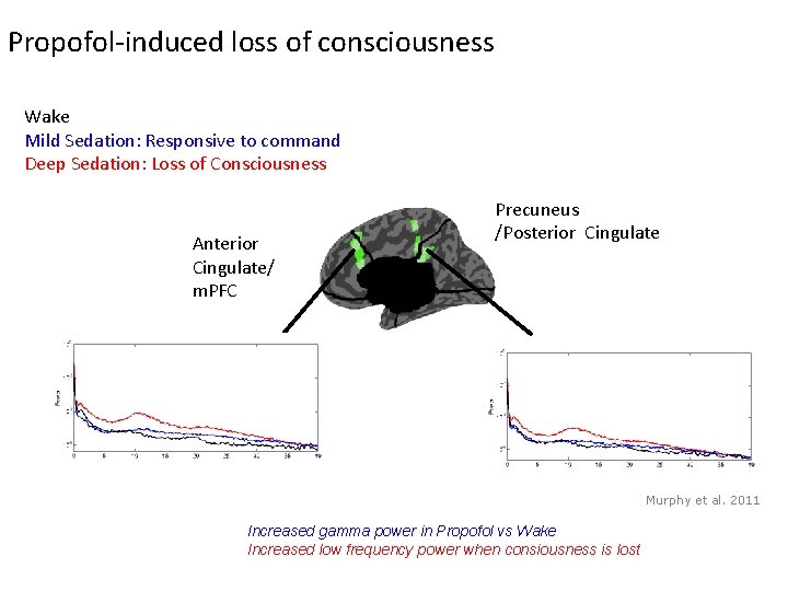 Propofol-induced loss of consciousness Wake Mild Sedation: Responsive to command Deep Sedation: Loss of Propofol-induced loss of consciousness Wake Mild Sedation: Responsive to command Deep Sedation: Loss of