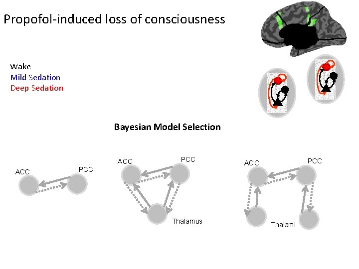 Propofol-induced loss of consciousness Wake Mild Sedation Deep Sedation Bayesian Model Selection ACC PCC Propofol-induced loss of consciousness Wake Mild Sedation Deep Sedation Bayesian Model Selection ACC PCC