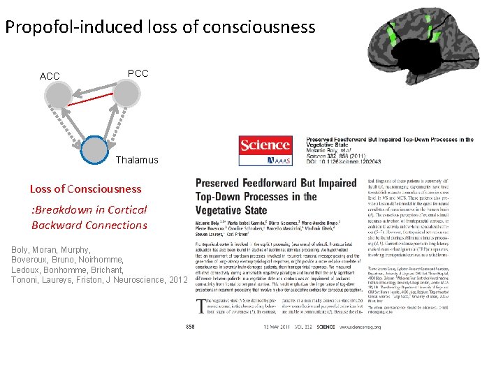Propofol-induced loss of consciousness ACC PCC Thalamus Loss of Consciousness : Breakdown in Cortical Propofol-induced loss of consciousness ACC PCC Thalamus Loss of Consciousness : Breakdown in Cortical
