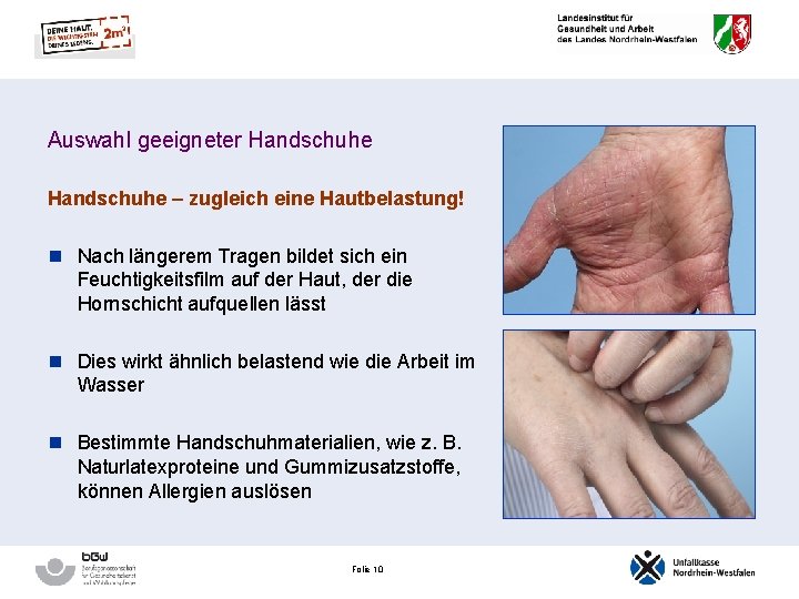 Auswahl geeigneter Handschuhe – zugleich eine Hautbelastung! n Nach längerem Tragen bildet sich ein