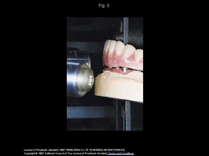 Fig. 3 Journal of Prosthetic Dentistry 1997 78550 -553 DOI: (10. 1016/S 0022 -3913(97)70004