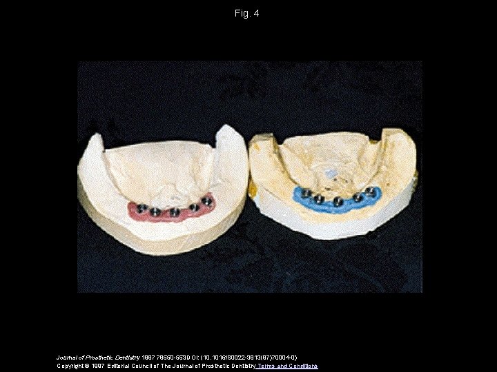 Fig. 4 Journal of Prosthetic Dentistry 1997 78550 -553 DOI: (10. 1016/S 0022 -3913(97)70004