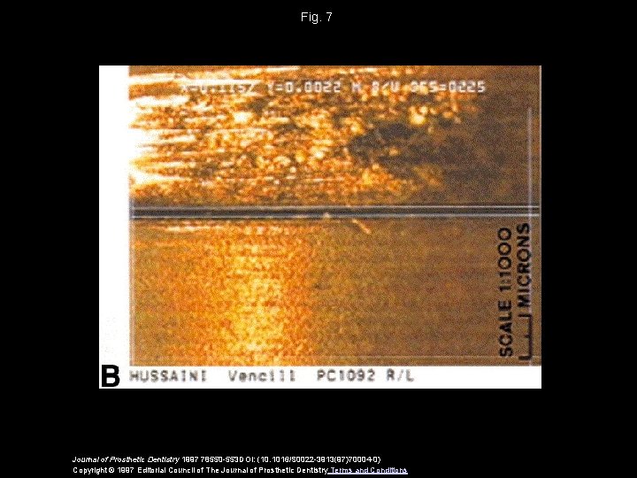 Fig. 7 Journal of Prosthetic Dentistry 1997 78550 -553 DOI: (10. 1016/S 0022 -3913(97)70004