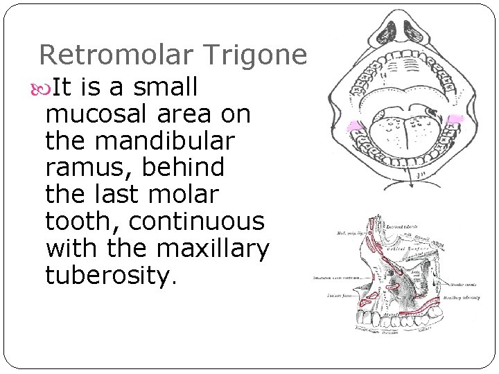 Retromolar Trigone It is a small mucosal area on the mandibular ramus, behind the Retromolar Trigone It is a small mucosal area on the mandibular ramus, behind the