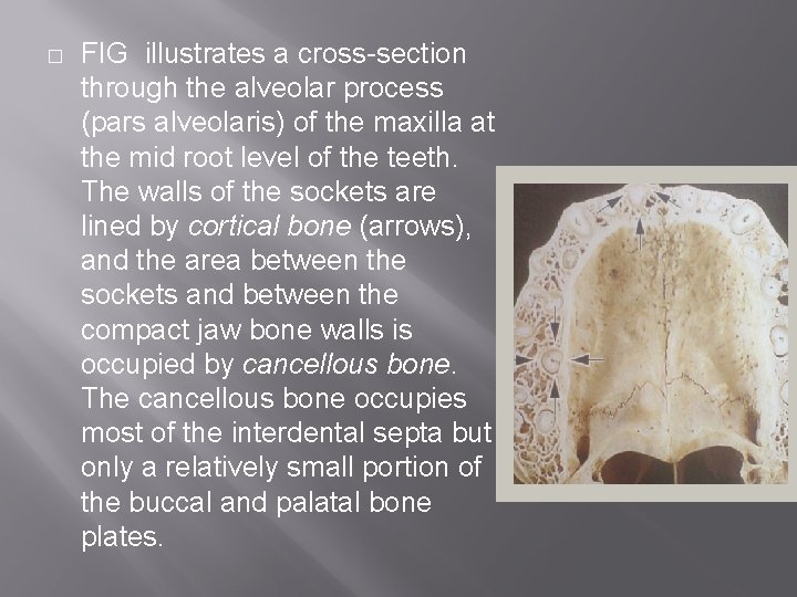 � FIG illustrates a cross-section through the alveolar process (pars alveolaris) of the maxilla