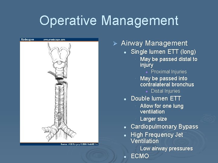 Operative Management Ø Airway Management l Single lumen ETT (long) • May be passed