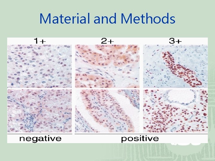 Material and Methods 