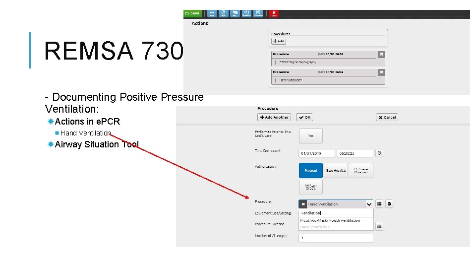 REMSA 7303 - Documenting Positive Pressure Ventilation: Actions in e. PCR Hand Ventilation Airway