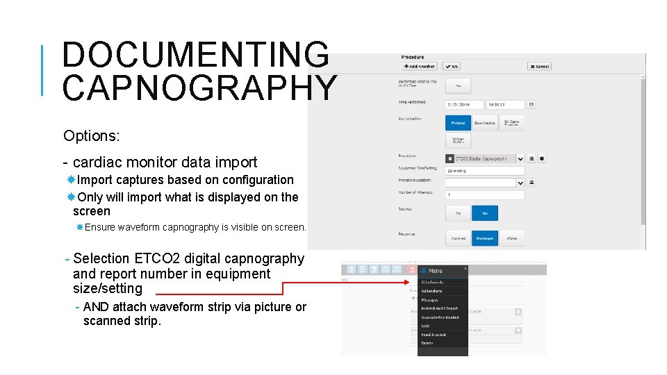 DOCUMENTING CAPNOGRAPHY Options: - cardiac monitor data import Import captures based on configuration Only