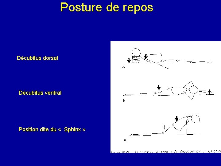 Posture de repos Décubitus dorsal Décubitus ventral Position dite du « Sphinx » 