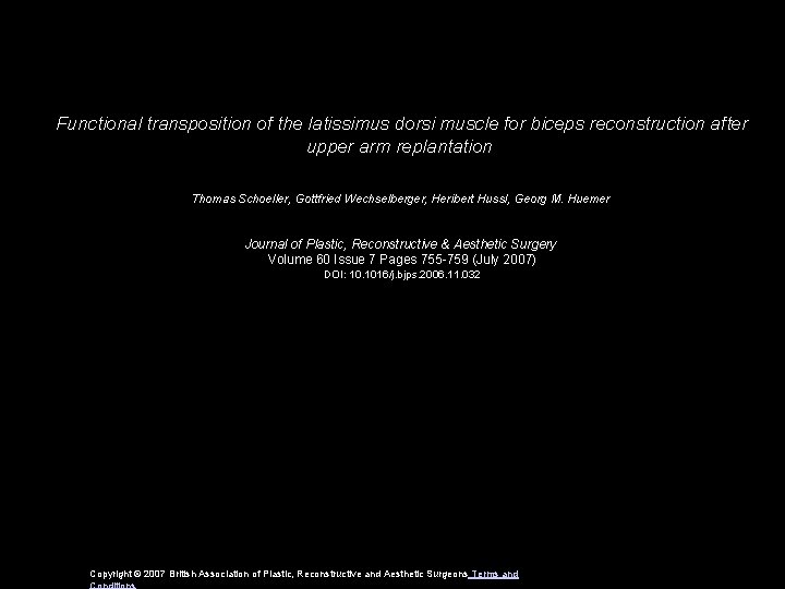 Functional transposition of the latissimus dorsi muscle for biceps reconstruction after upper arm replantation