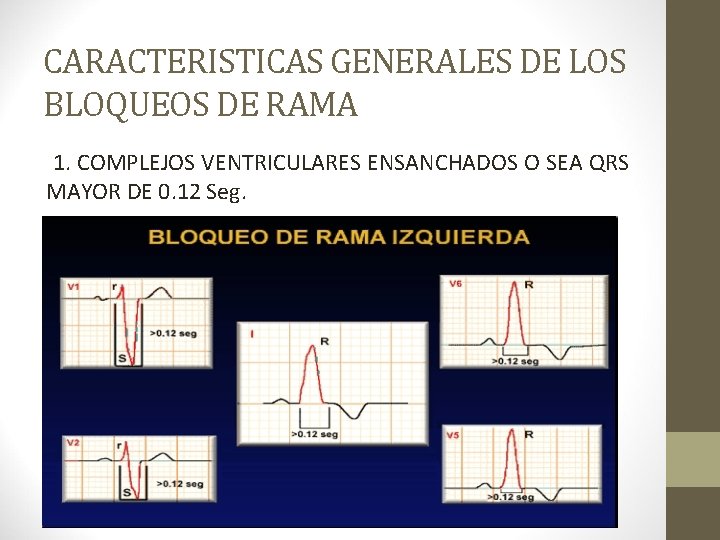 CARACTERISTICAS GENERALES DE LOS BLOQUEOS DE RAMA 1. COMPLEJOS VENTRICULARES ENSANCHADOS O SEA QRS CARACTERISTICAS GENERALES DE LOS BLOQUEOS DE RAMA 1. COMPLEJOS VENTRICULARES ENSANCHADOS O SEA QRS
