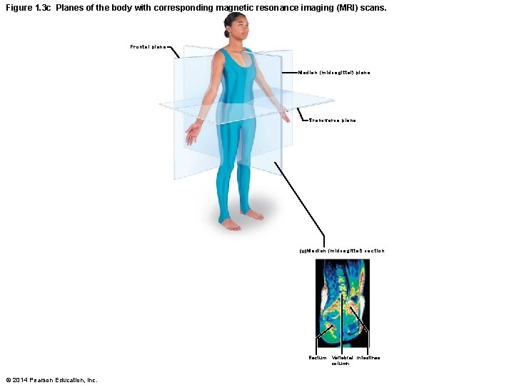 Figure 1. 3 c Planes of the body with corresponding magnetic resonance imaging (MRI)