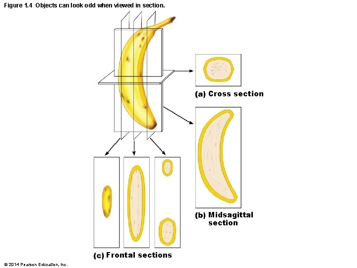 Figure 1. 4 Objects can look odd when viewed in section. Cross section Midsagittal