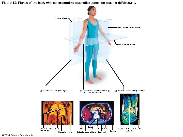 Figure 1. 3 Planes of the body with corresponding magnetic resonance imaging (MRI) scans.