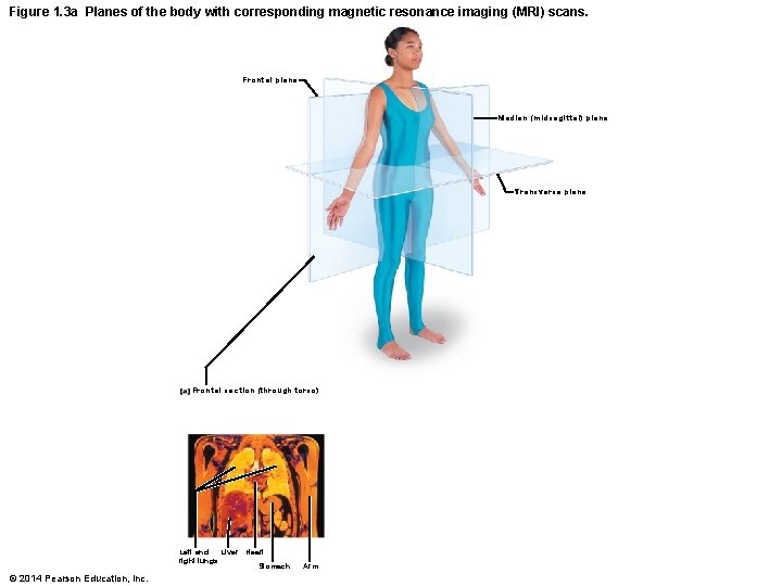 Figure 1. 3 a Planes of the body with corresponding magnetic resonance imaging (MRI)