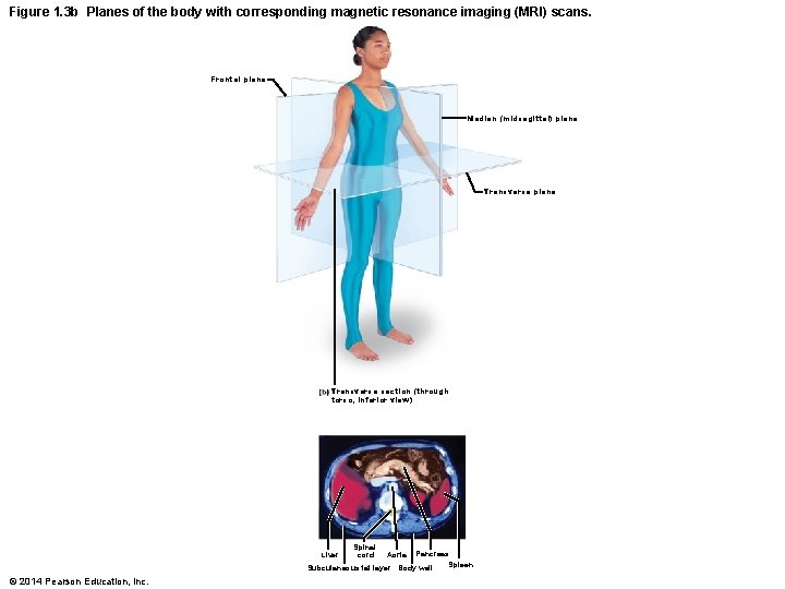 Figure 1. 3 b Planes of the body with corresponding magnetic resonance imaging (MRI)