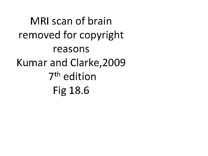 MRI scan of brain removed for copyright reasons Kumar and Clarke, 2009 7 th