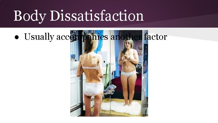 Body Dissatisfaction ● Usually accompanies another factor 