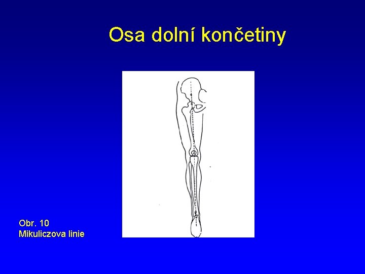Osa dolní končetiny Obr. 10 Mikuliczova linie 