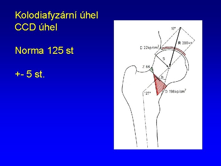 Kolodiafyzární úhel CCD úhel Norma 125 st +- 5 st. 