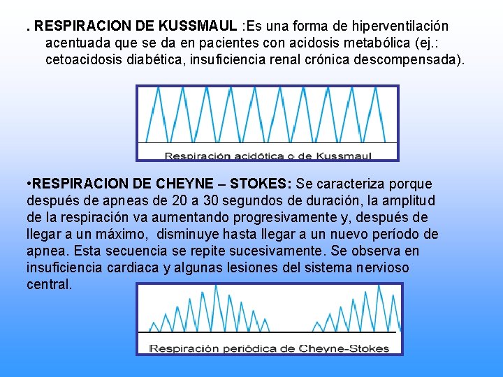 . RESPIRACION DE KUSSMAUL : Es una forma de hiperventilación acentuada que se da