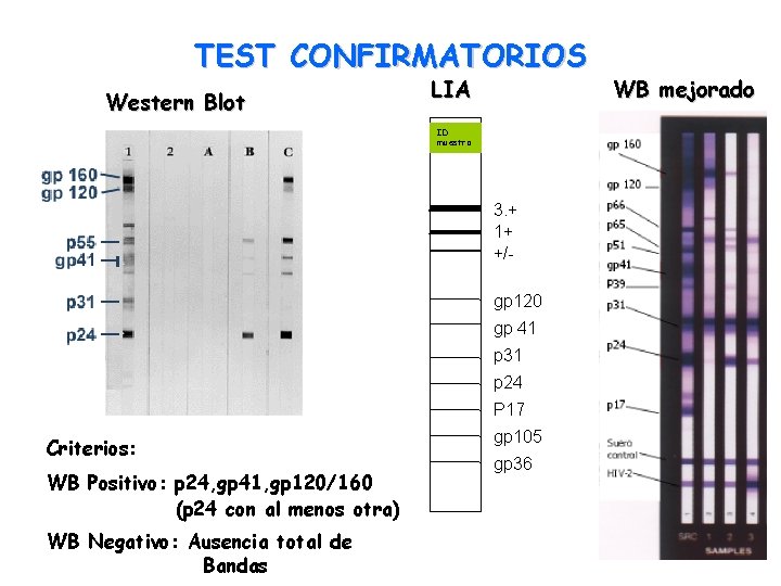 TEST CONFIRMATORIOS Western Blot LIA ID muestra 3. + 1+ +/gp 120 gp 41