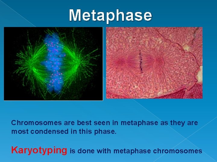 Metaphase Chromosomes are best seen in metaphase as they are most condensed in this