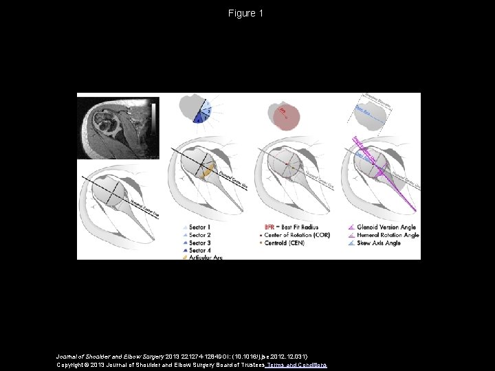 Figure 1 Journal of Shoulder and Elbow Surgery 2013 221274 -1284 DOI: (10. 1016/j.