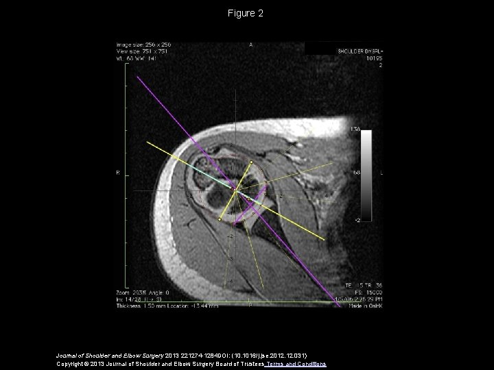 Figure 2 Journal of Shoulder and Elbow Surgery 2013 221274 -1284 DOI: (10. 1016/j.