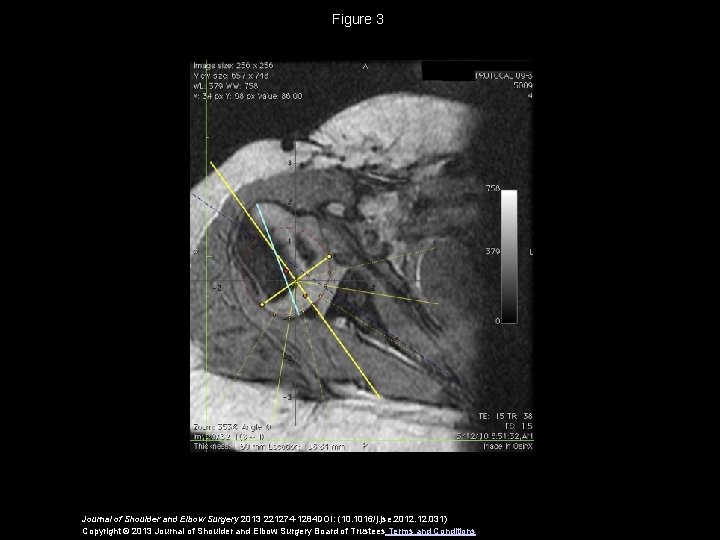 Figure 3 Journal of Shoulder and Elbow Surgery 2013 221274 -1284 DOI: (10. 1016/j.