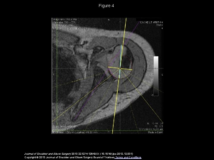 Figure 4 Journal of Shoulder and Elbow Surgery 2013 221274 -1284 DOI: (10. 1016/j.