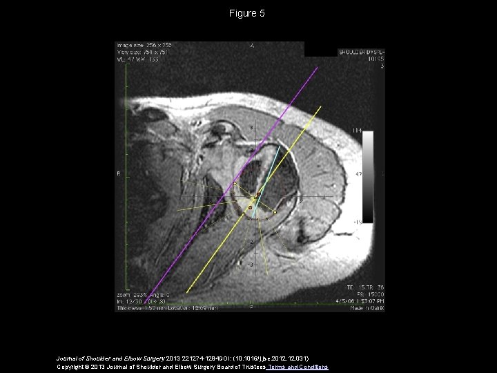 Figure 5 Journal of Shoulder and Elbow Surgery 2013 221274 -1284 DOI: (10. 1016/j.