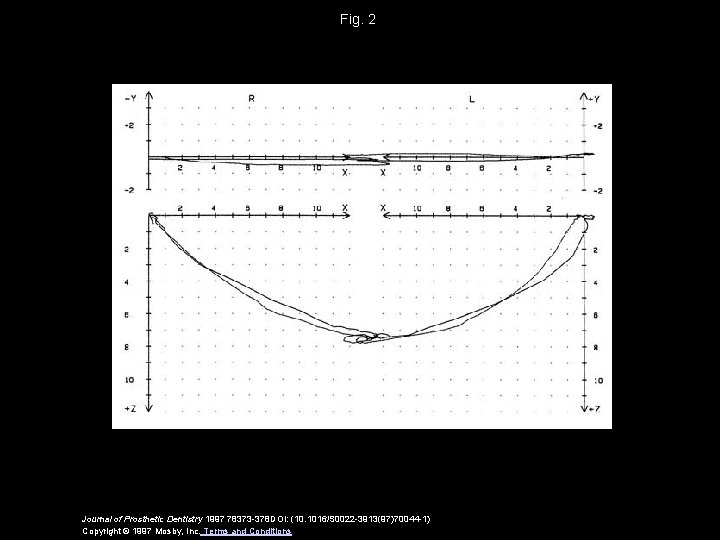 Fig. 2 Journal of Prosthetic Dentistry 1997 78373 -378 DOI: (10. 1016/S 0022 -3913(97)70044