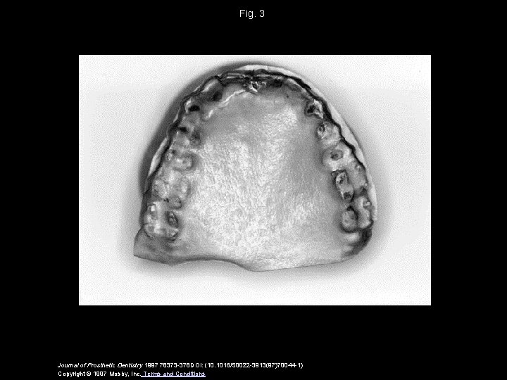 Fig. 3 Journal of Prosthetic Dentistry 1997 78373 -378 DOI: (10. 1016/S 0022 -3913(97)70044