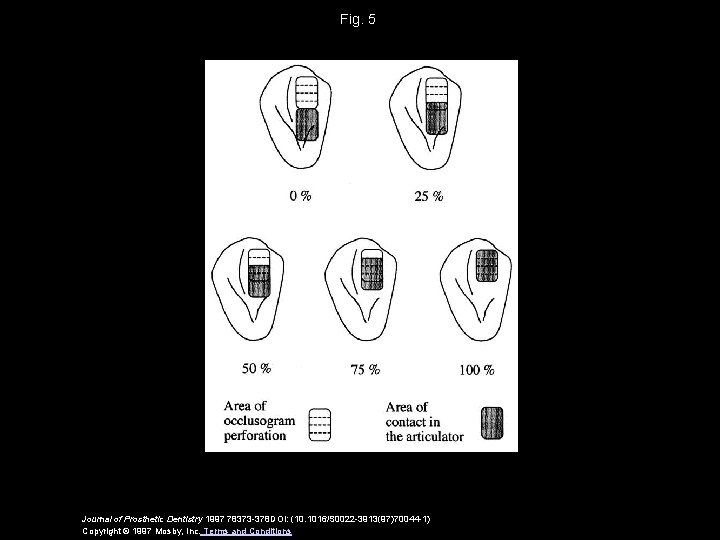 Fig. 5 Journal of Prosthetic Dentistry 1997 78373 -378 DOI: (10. 1016/S 0022 -3913(97)70044