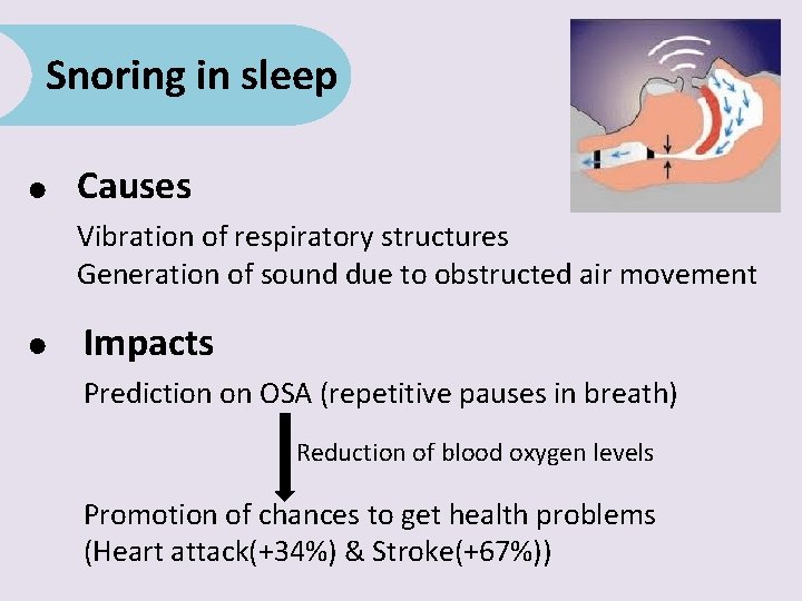 Snoring in sleep ● Causes Vibration of respiratory structures Generation of sound due to