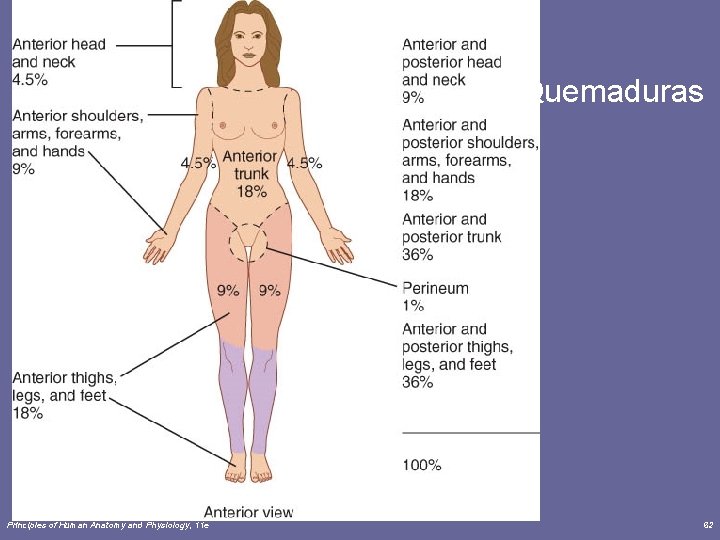 Quemaduras Principles of Human Anatomy and Physiology, 11 e 62 