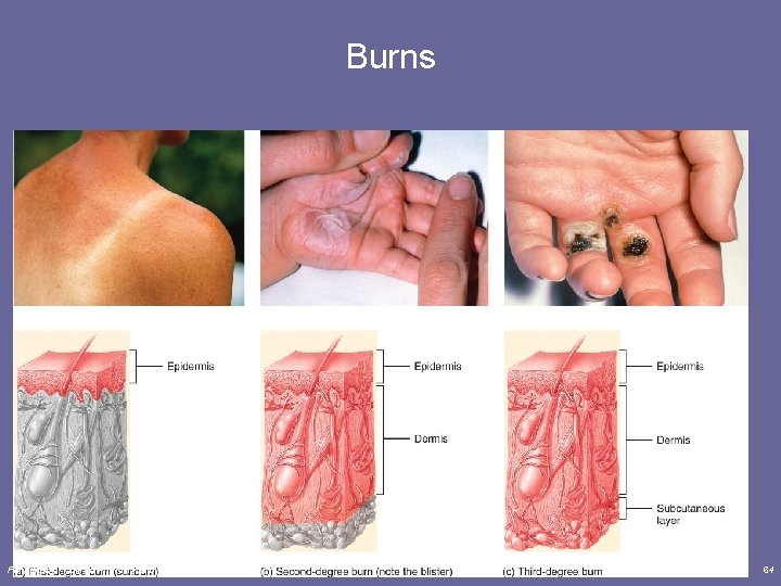 Burns Principles of Human Anatomy and Physiology, 11 e 64 