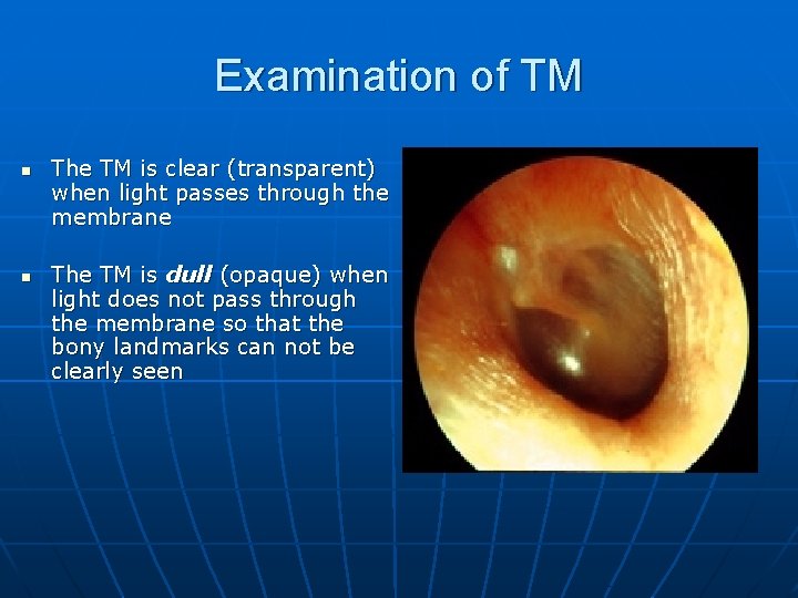 Examination of TM n n The TM is clear (transparent) when light passes through