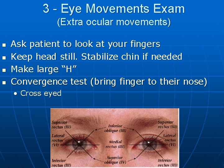 3 - Eye Movements Exam (Extra ocular movements) n n Ask patient to look